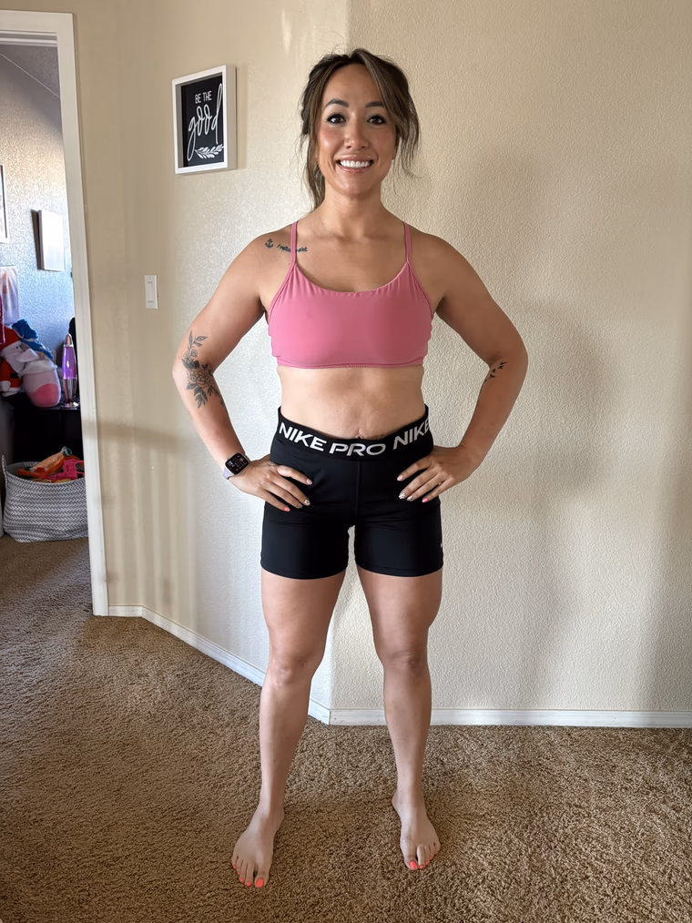 Crystal G. after treatment.