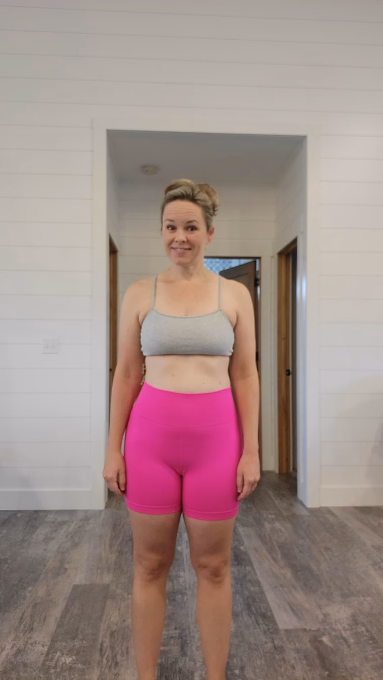 Kim B. after treatment.