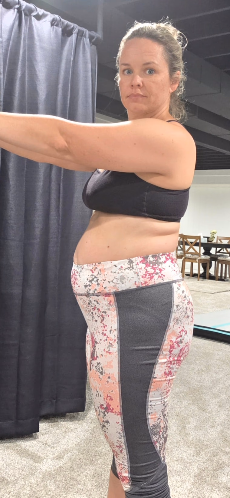 Kim B. before beginning treatment.