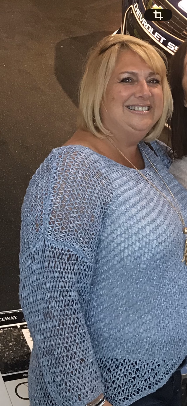 Lisa C. before starting treatment.